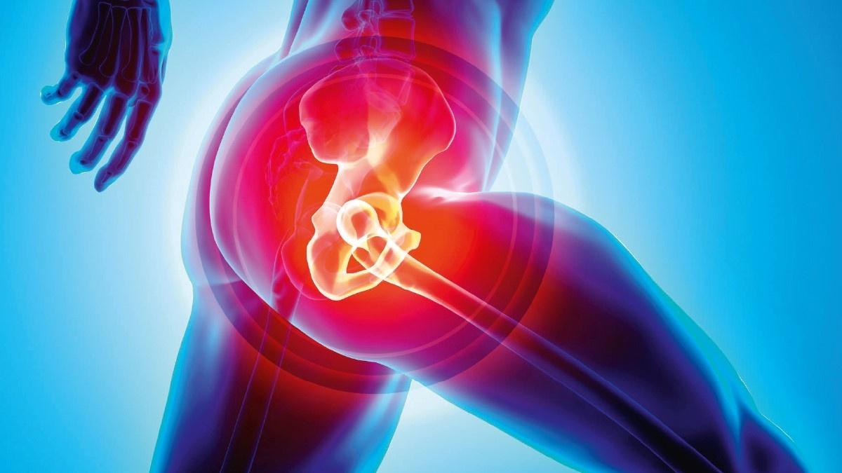Hip Arthritis ? Causes Symptoms & Treatment
